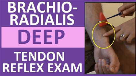 Nursing head to toe assessment includes the deep tendon reflex examination of the brachioradialis tendon (C5 to C6) with a reflex hammer. This …